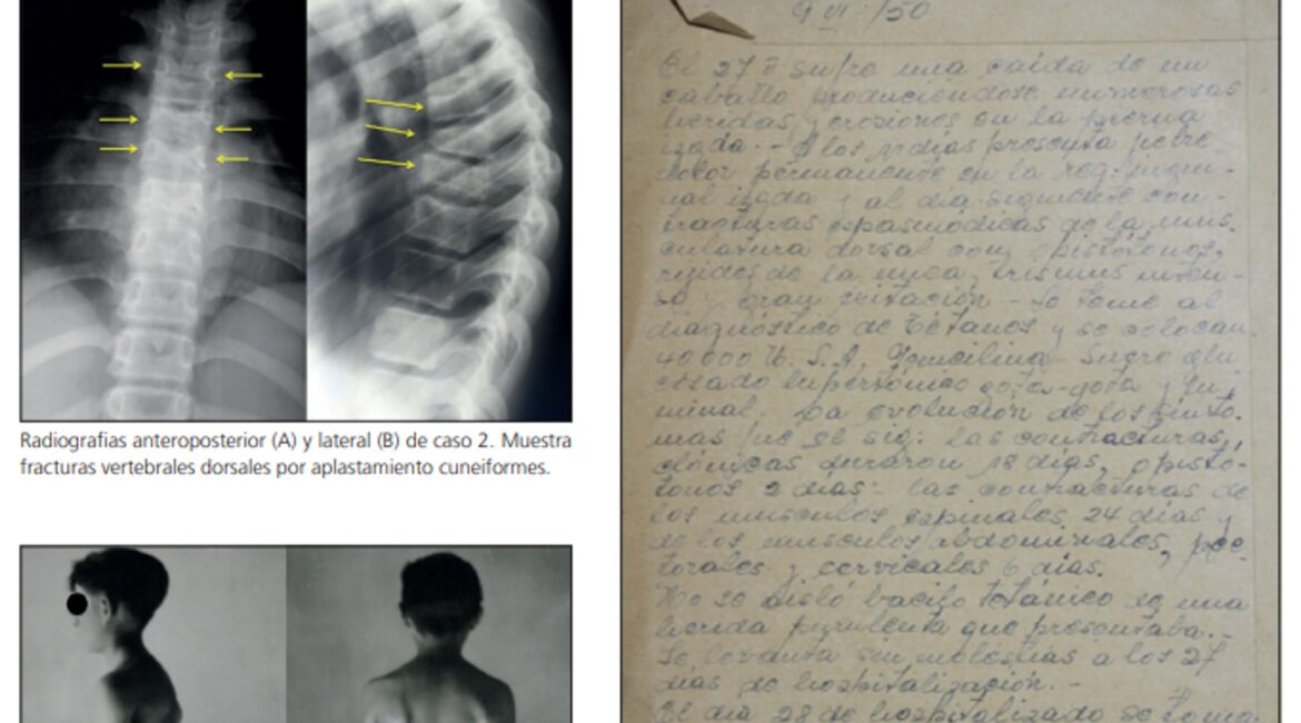 Preservación de Colección Radiológica Infantil del Hospital San Borja Arriarán