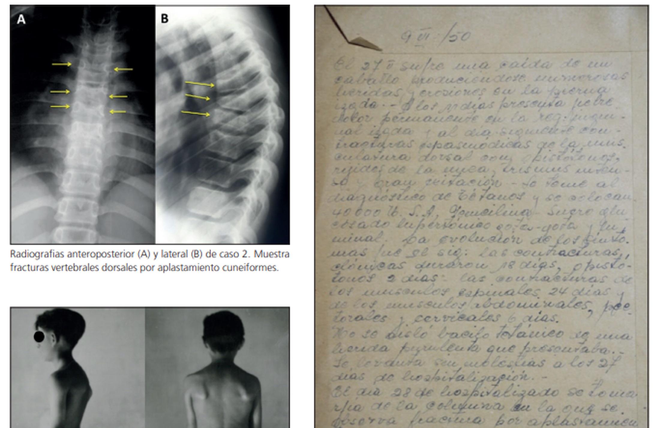 Preservación de Colección Radiológica Infantil del Hospital San Borja Arriarán